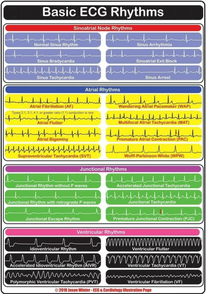 Pin By Carla Chipman On Medical Emergency Nursing Critical Care 